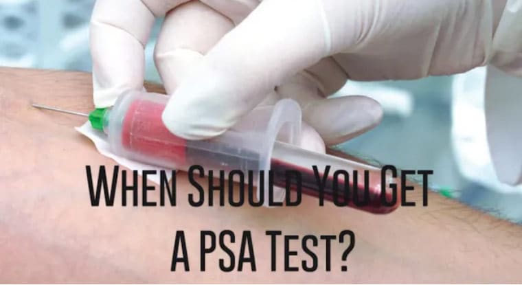 When Should You Get A PSA Test?