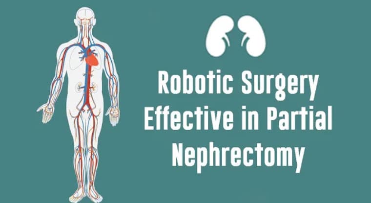 Robotic Surgery Effective in Partial Nephrectomy