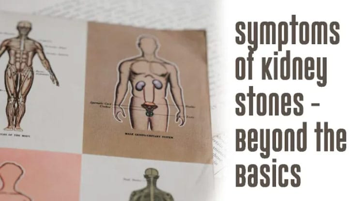 Symptoms of Kidney Stones -Beyond the Basics