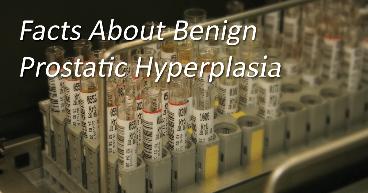 Facts About Benign Prostatic Hyperplasia (BPH)
