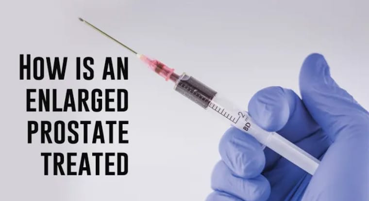 How is an enlarged prostate treated