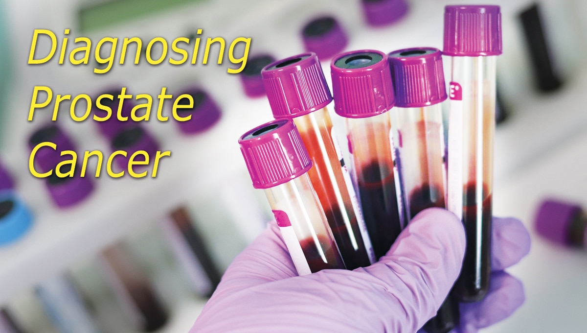 Diagnosing Prostate Cancer