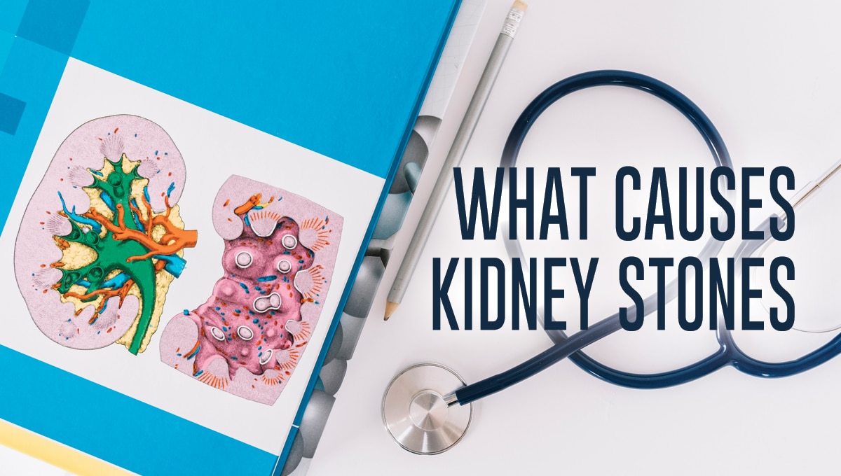What Causes Kidney Stones by Dr. Howard Epstein