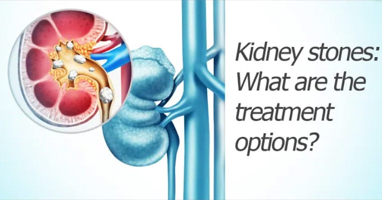Kidney stones: What are the treatment options?