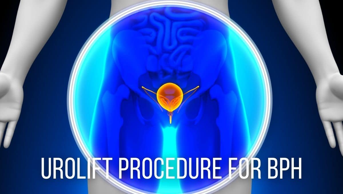 How Does UroLift Procedure for BPH Work, According to Dr. David Harris?