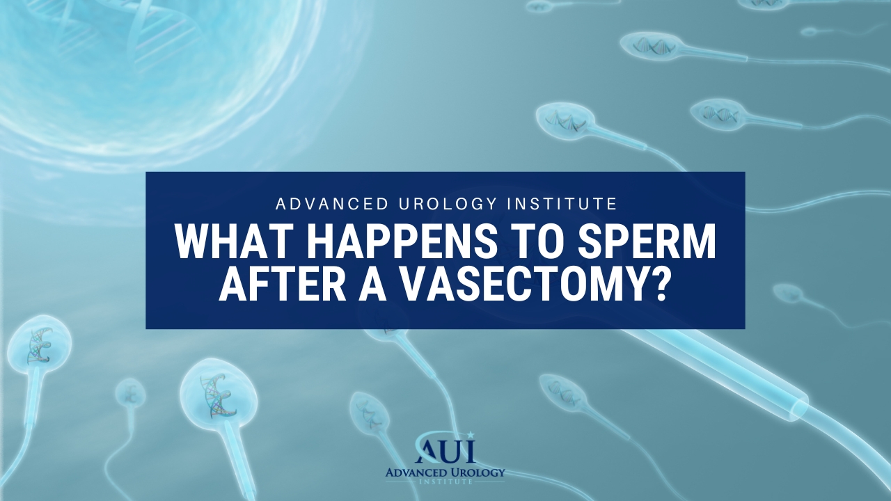 What happens to sperm after a vasectomy?