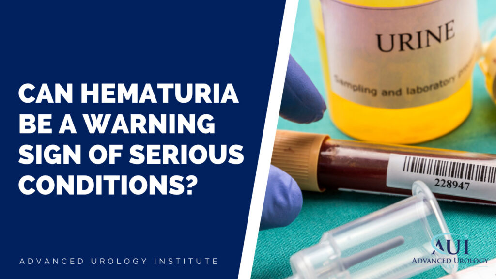 Can Hematuria be a warning sign of serious conditions