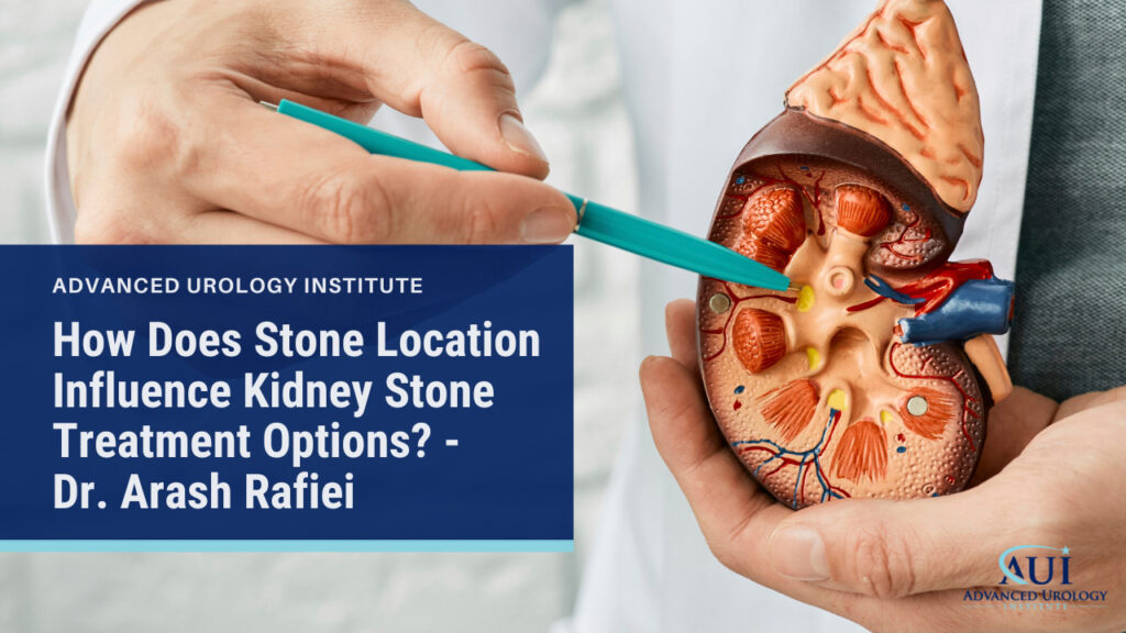 How Does Stone Location Influence Kidney Stone Treatment Options? - Dr. Arash Rafiei