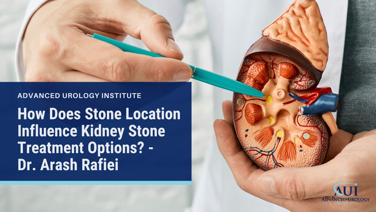 How Does Stone Location Influence Kidney Stone Treatment Options? - Dr. Arash Rafiei