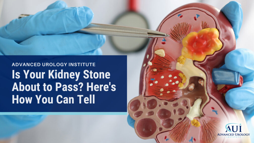 Is Your Kidney Stone About to Pass? Here's How You Can Tell