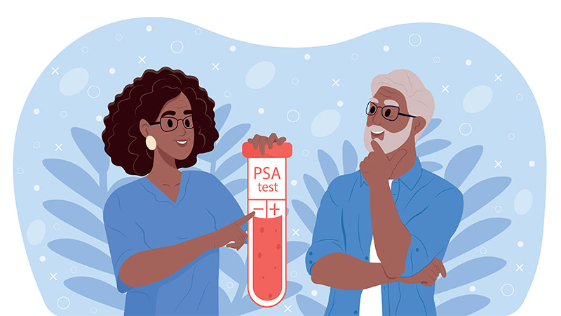Guide to the PSA Prostate Test: What Your Results Mean